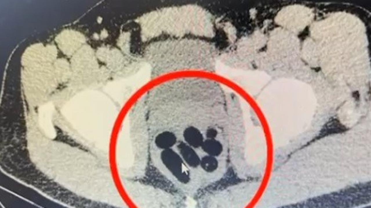 kayseride uyusturucu operasyonu midesinden cikan soke etti xmaVicWp.jpg